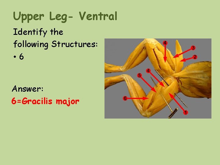 Upper Leg- Ventral Identify the following Structures: • 6 Answer: 6=Gracilis major Upper Leg- Ventral Identify the following Structures: • 6 Answer: 6=Gracilis major