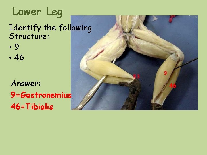 Lower Leg Identify the following Structure: • 9 • 46 Answer: 9=Gastronemius 46=Tibialis 46 Lower Leg Identify the following Structure: • 9 • 46 Answer: 9=Gastronemius 46=Tibialis 46