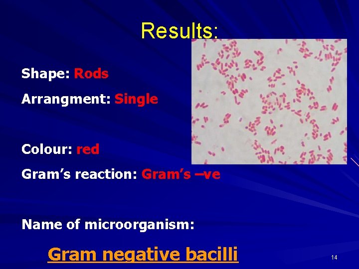 Results: Shape: Rods Arrangment: Single Colour: red Gram’s reaction: Gram’s –ve Name of microorganism: