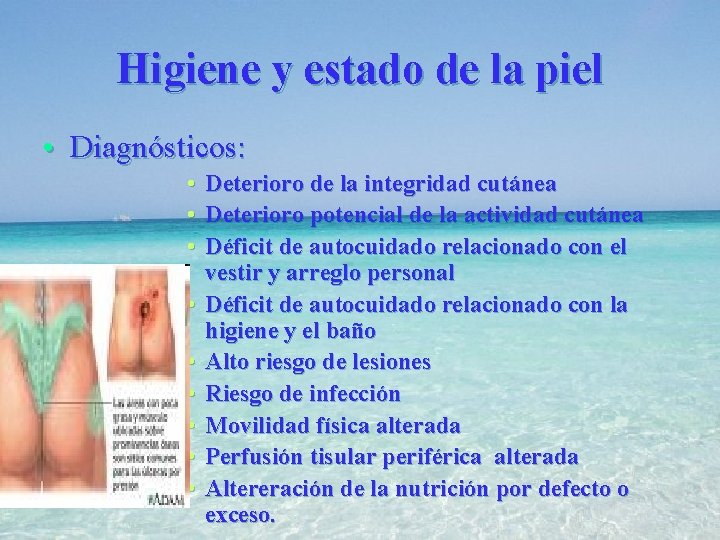 Higiene y estado de la piel • Diagnósticos: • Deterioro de la integridad cutánea