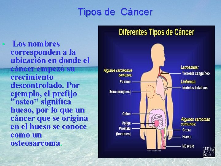 Tipos de Cáncer • Los nombres corresponden a la ubicación en donde el cáncer