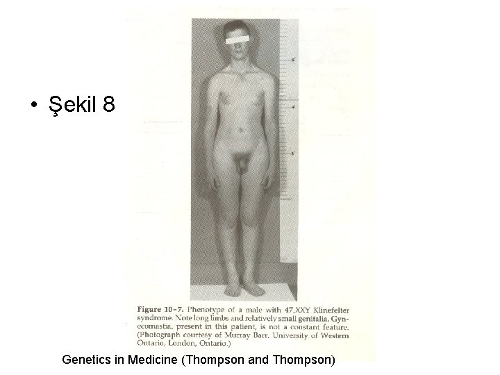  • Şekil 8 Genetics in Medicine (Thompson and Thompson) 