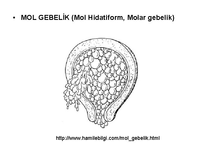  • MOL GEBELİK (Mol Hidatiform, Molar gebelik) http: //www. hamilebilgi. com/mol_gebelik. html 