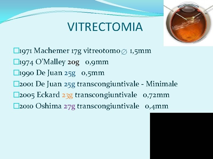 VITRECTOMIA � 1971 Machemer 17 g vitreotomo 1, 5 mm � 1974 O’Malley 20