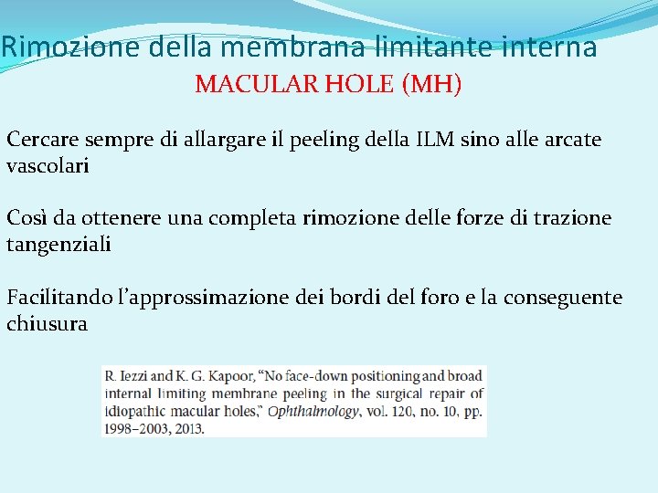 Rimozione della membrana limitante interna MACULAR HOLE (MH) Cercare sempre di allargare il peeling
