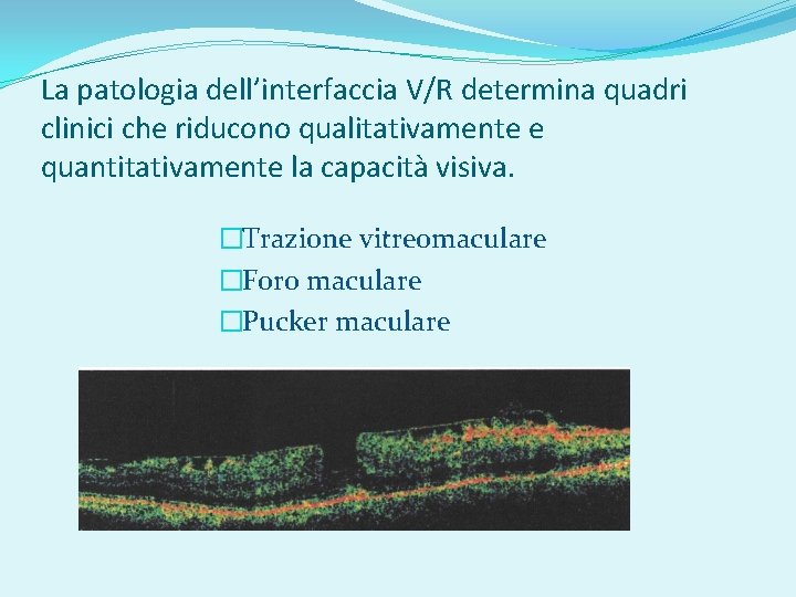La patologia dell’interfaccia V/R determina quadri clinici che riducono qualitativamente e quantitativamente la capacità