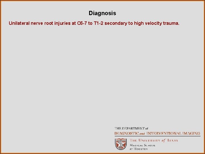 Diagnosis Unilateral nerve root injuries at C 6 -7 to T 1 -2 secondary
