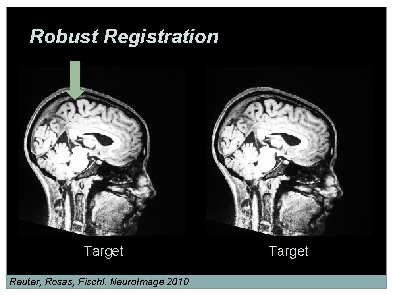 Robust Registration Target Reuter, Rosas, Fischl. Neuro. Image 2010 Target 