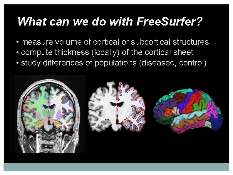 What can we do with Free. Surfer? • measure volume of cortical or subcortical