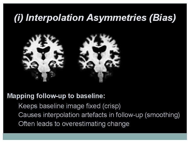 (i) Interpolation Asymmetries (Bias) Mapping follow-up to baseline: • Keeps baseline image fixed (crisp)