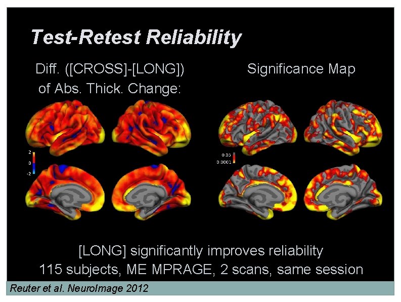 Test-Retest Reliability Diff. ([CROSS]-[LONG]) of Abs. Thick. Change: Significance Map [LONG] significantly improves reliability