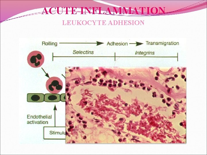 ACUTE INFLAMMATION LEUKOCYTE ADHESION 