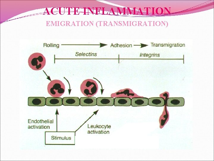 ACUTE INFLAMMATION EMIGRATION (TRANSMIGRATION) 