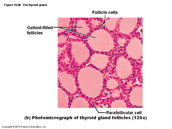 Figure 16. 8 b The thyroid gland. Follicle cells Colloid-filled follicles Parafollicular cell (b)
