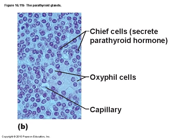 Figure 16. 11 b The parathyroid glands. Chief cells (secrete parathyroid hormone) Oxyphil cells