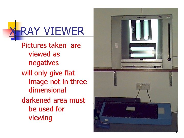 X-RAY VIEWER Pictures taken are viewed as negatives will only give flat image not