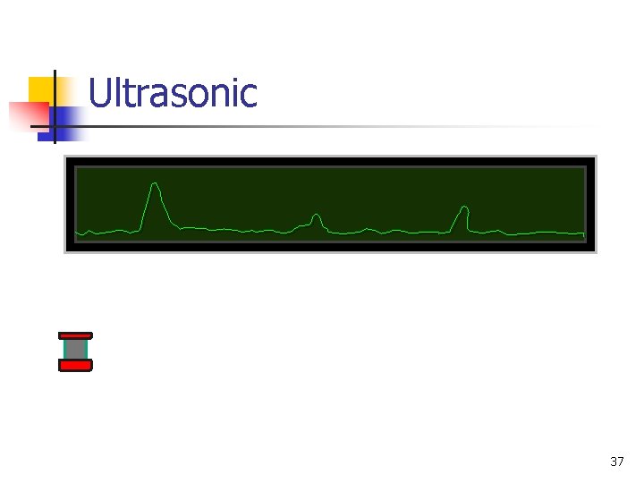 Ultrasonic 37 