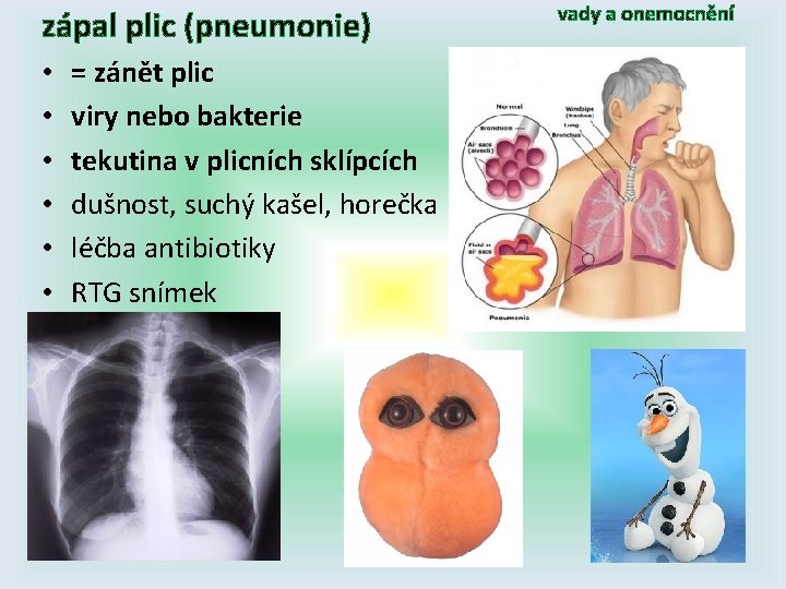 zápal plic (pneumonie) • • • = zánět plic viry nebo bakterie tekutina v