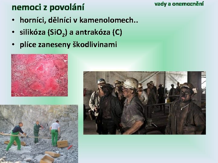 nemoci z povolání • horníci, dělníci v kamenolomech. . • silikóza (Si. O 2)