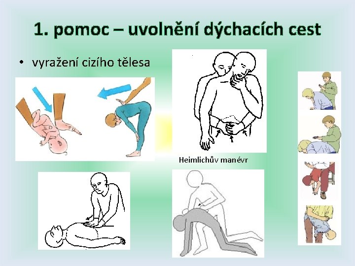 1. pomoc – uvolnění dýchacích cest • vyražení cizího tělesa Heimlichův manévr 