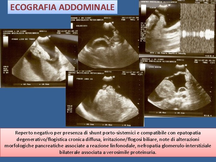 ECOGRAFIA ADDOMINALE Reperto negativo per presenza di shunt porto-sistemici e compatibile con epatopatia degenerativo/flogistica