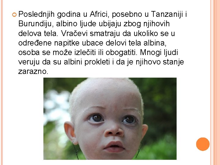  Poslednjih godina u Africi, posebno u Tanzaniji i Burundiju, albino ljude ubijaju zbog