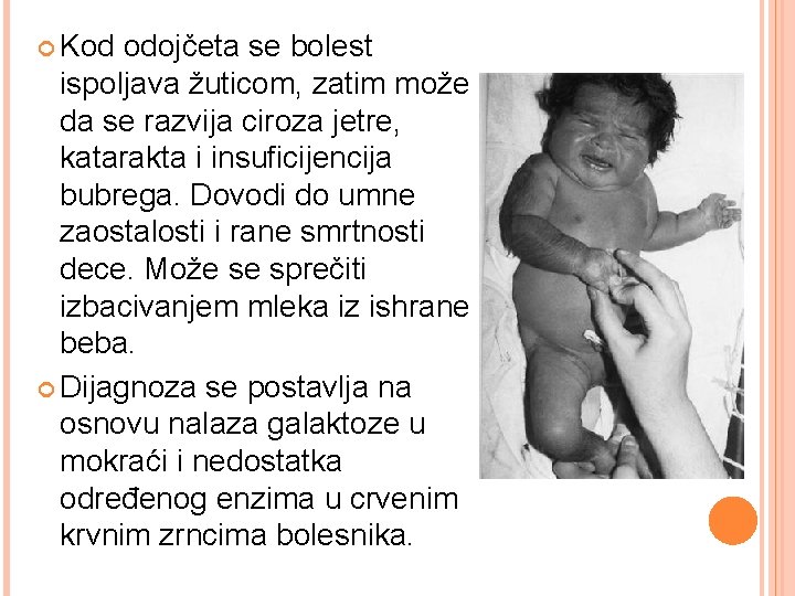  Kod odojčeta se bolest ispoljava žuticom, zatim može da se razvija ciroza jetre,