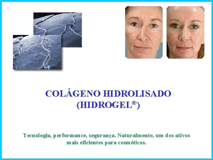 COLÁGENO HIDROLISADO (HIDROGEL®) Tecnologia, performance, segurança. Naturalmente, um dos ativos mais eficientes para cosméticos.