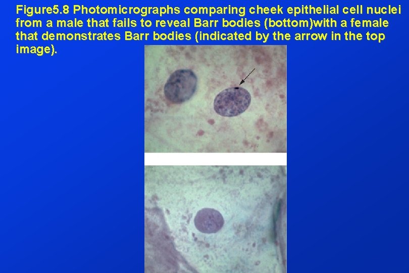 Figure 5. 8 Photomicrographs comparing cheek epithelial cell nuclei from a male that fails