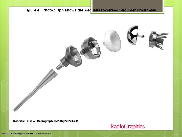 Figure 4. Photograph shows the Aequalis Reversed Shoulder Prosthesis. Roberts C C et al. Figure 4. Photograph shows the Aequalis Reversed Shoulder Prosthesis. Roberts C C et al.