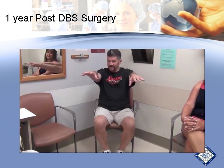1 year Post DBS Surgery 1 year Post DBS Surgery