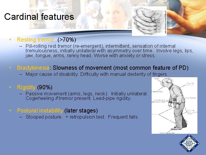 Cardinal features • Resting tremor (>70%) – Pill-rolling rest tremor (re-emergent), intermittent, sensation of Cardinal features • Resting tremor (>70%) – Pill-rolling rest tremor (re-emergent), intermittent, sensation of