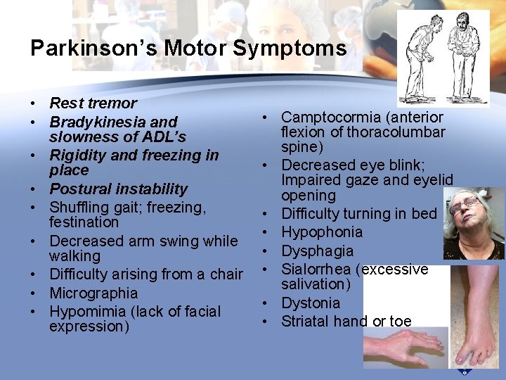 Parkinson’s Motor Symptoms • Rest tremor • Bradykinesia and slowness of ADL’s • Rigidity Parkinson’s Motor Symptoms • Rest tremor • Bradykinesia and slowness of ADL’s • Rigidity