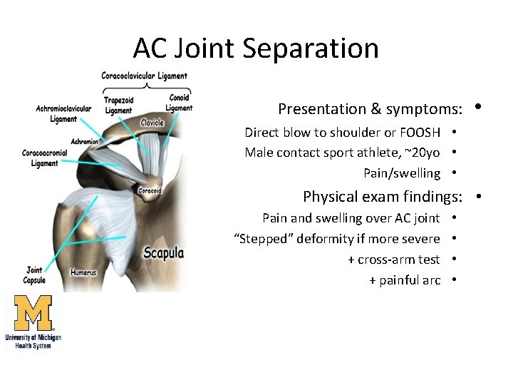 AC Joint Separation Presentation & symptoms: • Direct blow to shoulder or FOOSH •