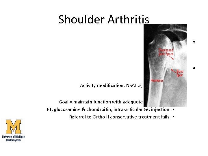 Shoulder Arthritis Diagnosis: • Clinical + • Xray • Management: • AC joint: •
