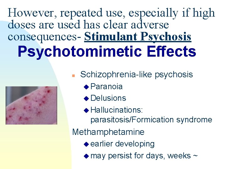 However, repeated use, especially if high doses are used has clear adverse consequences- Stimulant