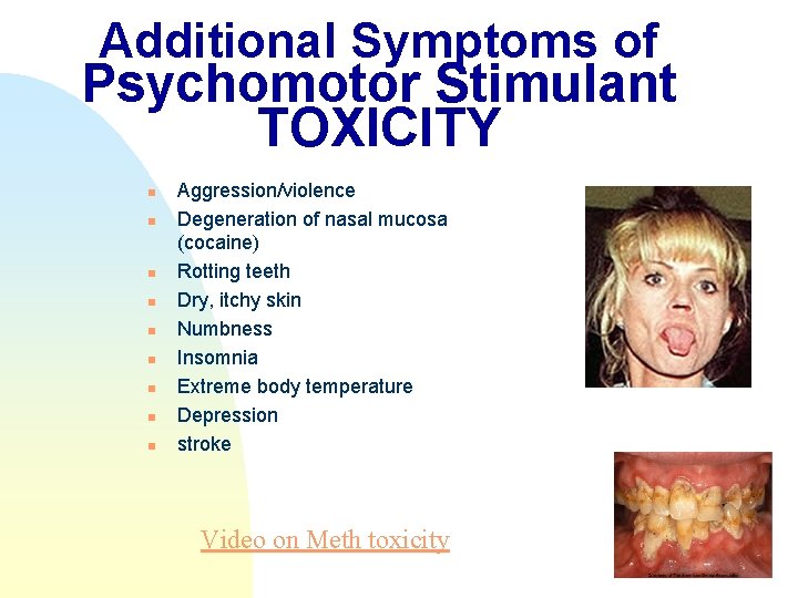 Additional Symptoms of Psychomotor Stimulant TOXICITY n n n n n Aggression/violence Degeneration of