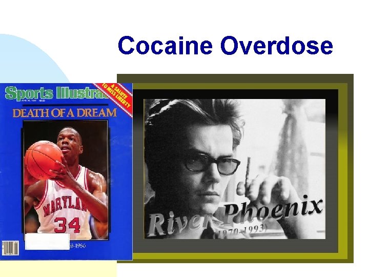 Cocaine Overdose 