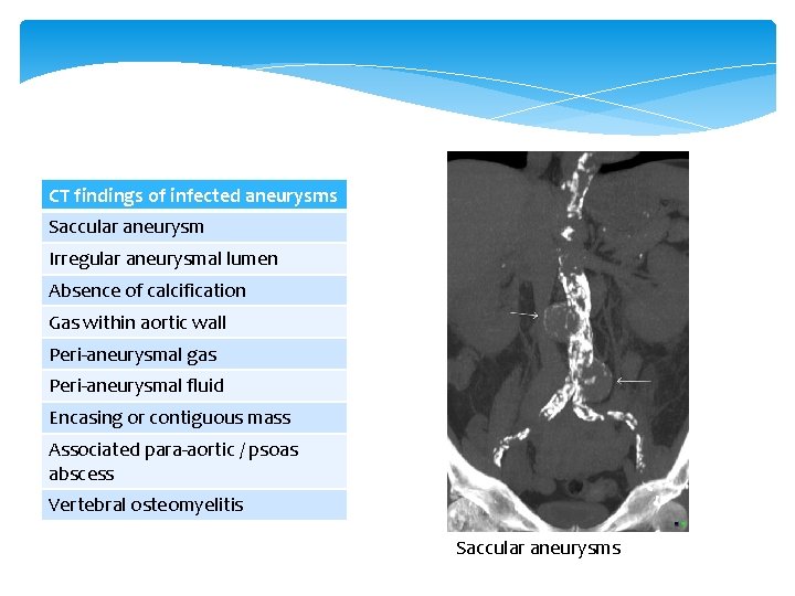 CT findings of infected aneurysms Saccular aneurysm Irregular aneurysmal lumen Absence of calcification Gas