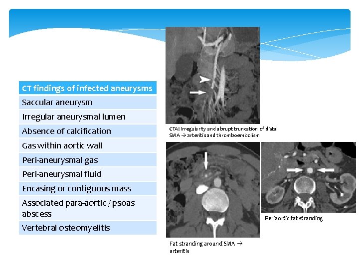 CT findings of infected aneurysms Saccular aneurysm Irregular aneurysmal lumen Absence of calcification CTA: