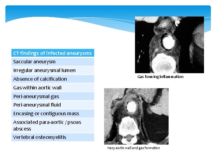 CT findings of infected aneurysms Saccular aneurysm Irregular aneurysmal lumen Absence of calcification Gas