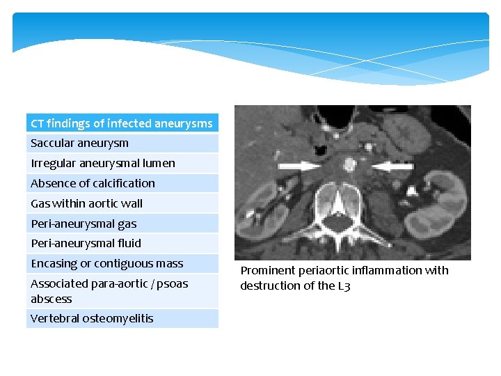 CT findings of infected aneurysms Saccular aneurysm Irregular aneurysmal lumen Absence of calcification Gas