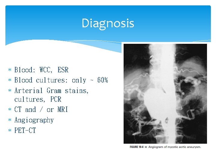 Diagnosis Blood: WCC, ESR Blood cultures: only ~ 60% Arterial Gram stains, cultures, PCR