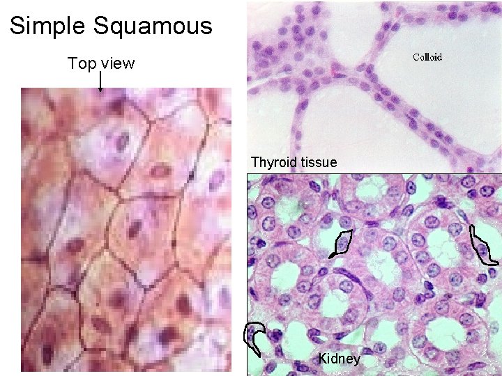 Simple Squamous Top view Thyroid tissue Kidney 