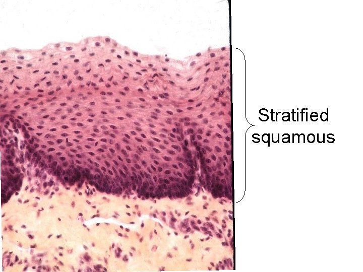 Stratified squamous 