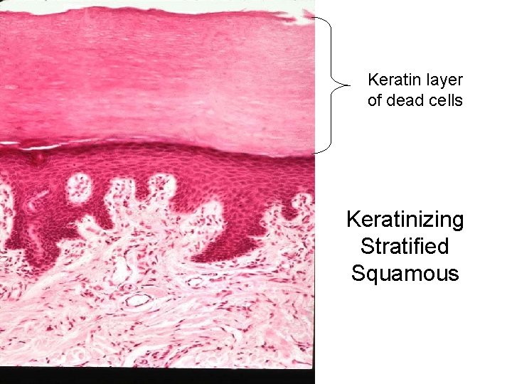 Keratin layer of dead cells Keratinizing Stratified Squamous 