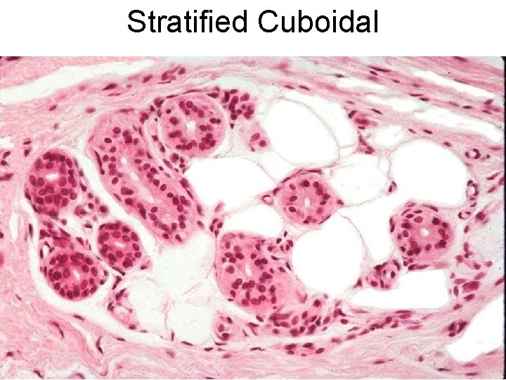 Stratified Cuboidal 