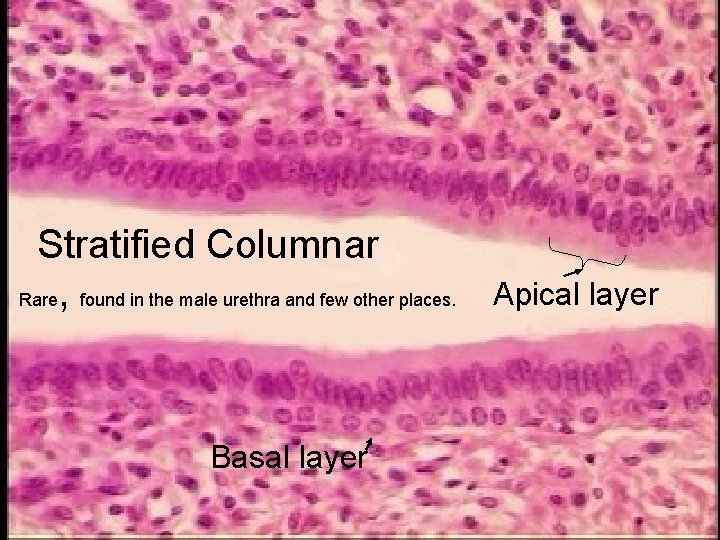 Stratified Columnar Rare, found in the male urethra and few other places. Basal layer