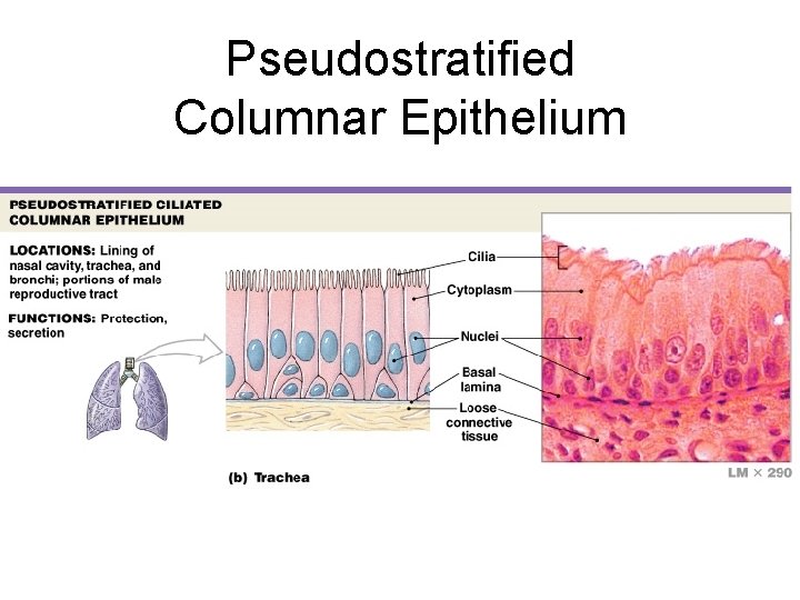 Pseudostratified Columnar Epithelium 