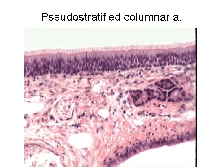 Pseudostratified columnar a. 